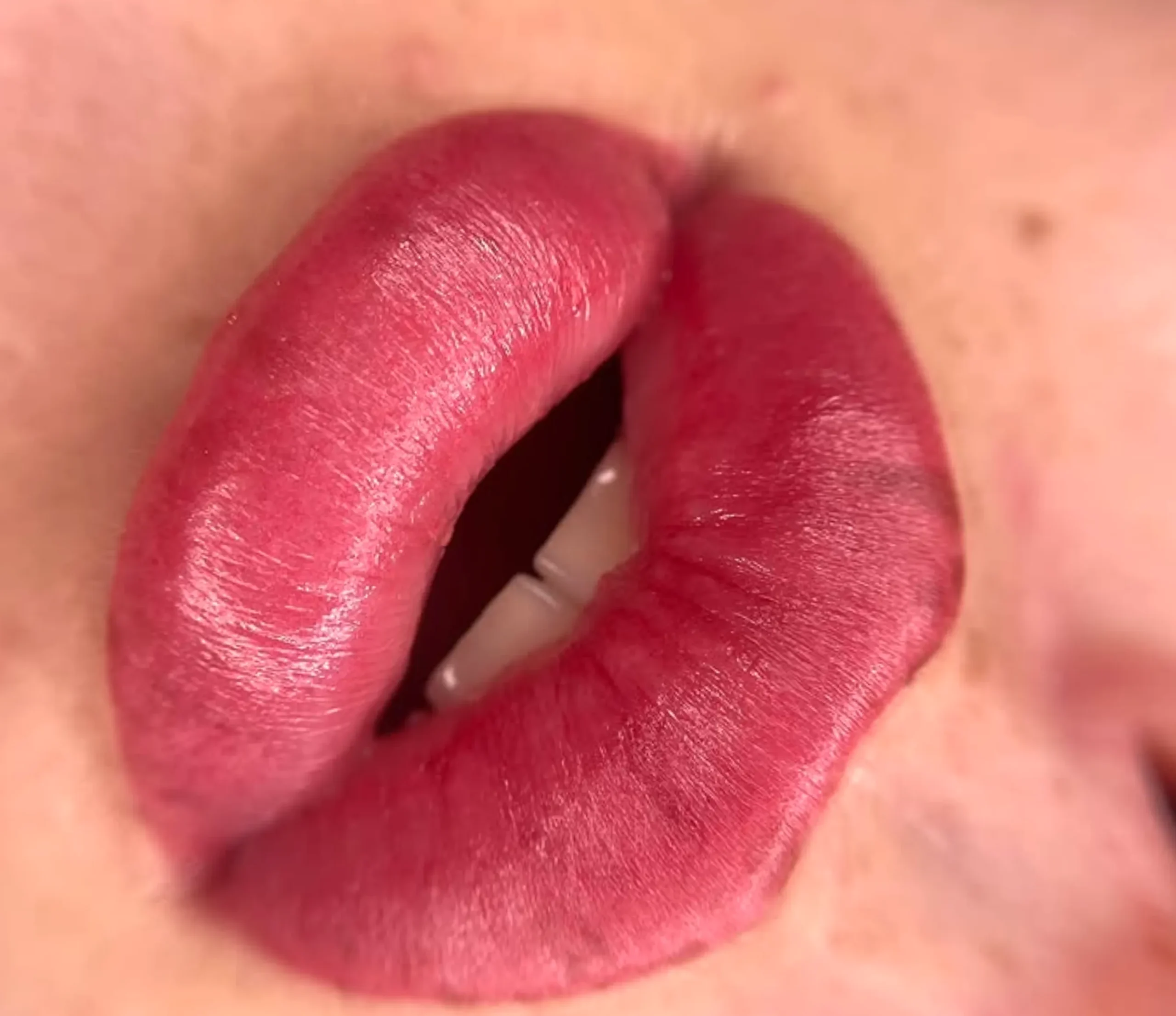 lip tattoo cold sores risk