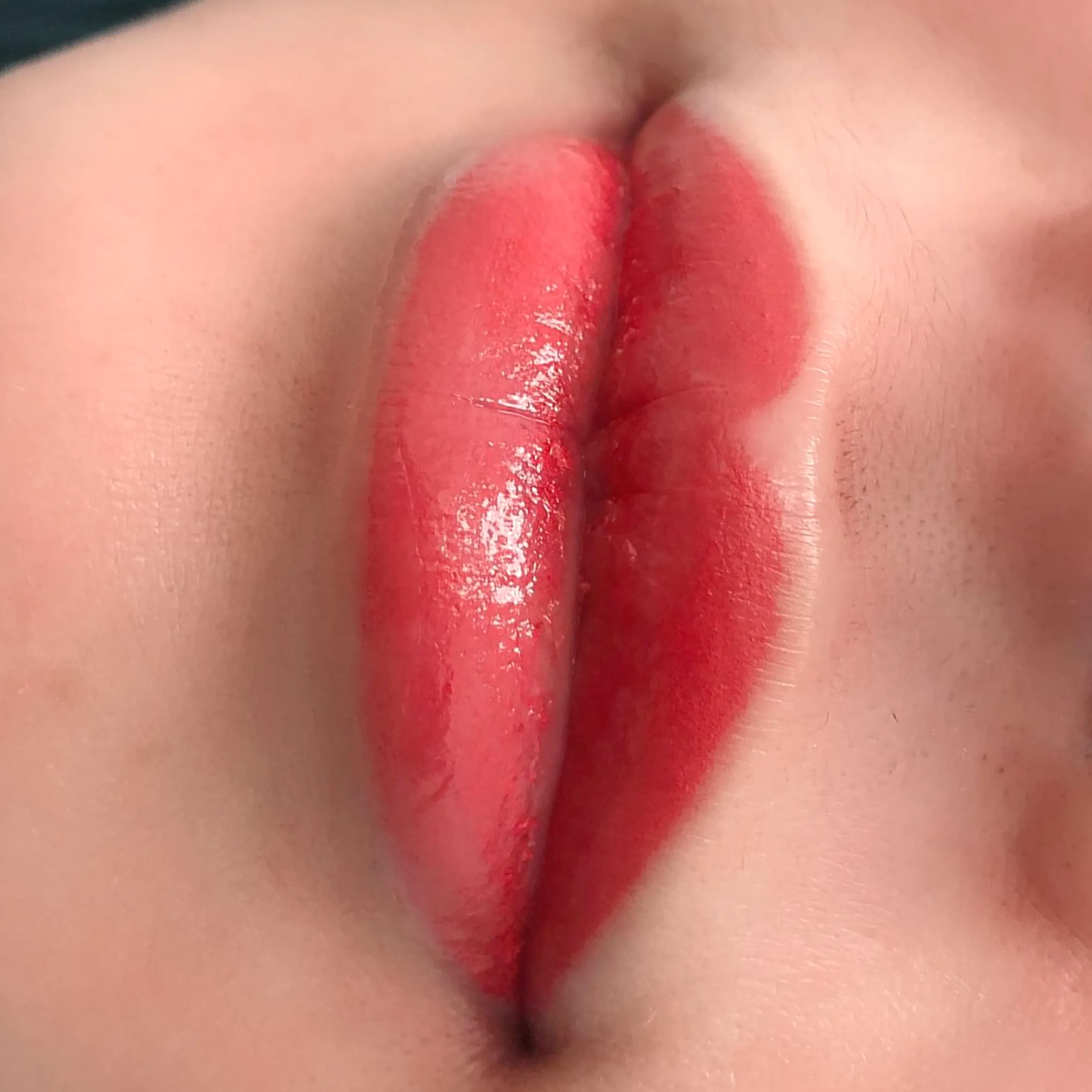 lip tattoo swelling